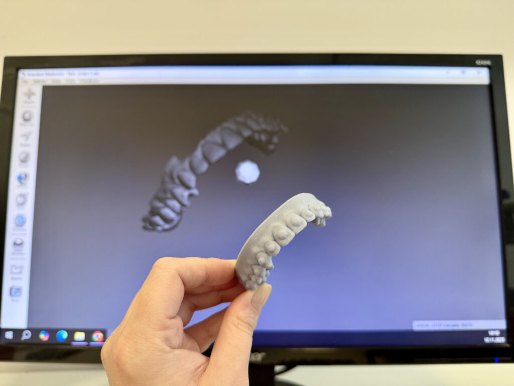 wybielanie-zebow-nakladkowe-pressdots