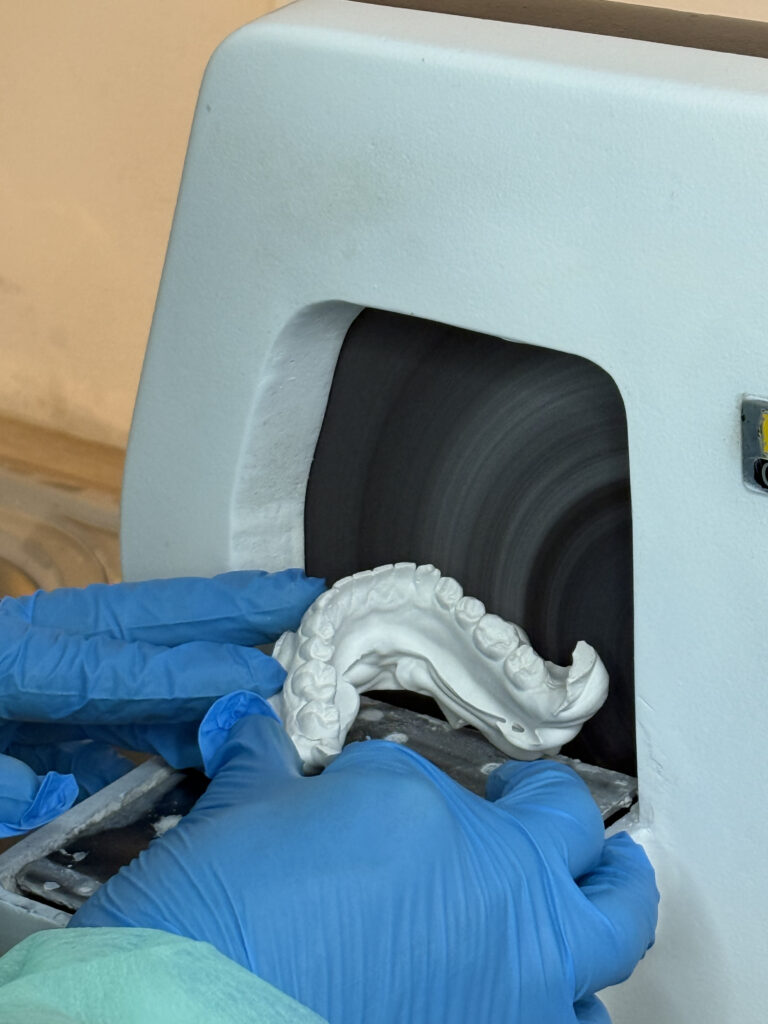 wybielanie-zebow-nakladkowe-pressdots