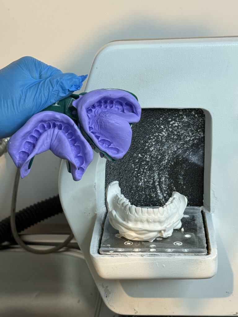 wybielanie-zebow-nakladkowe-pressdots