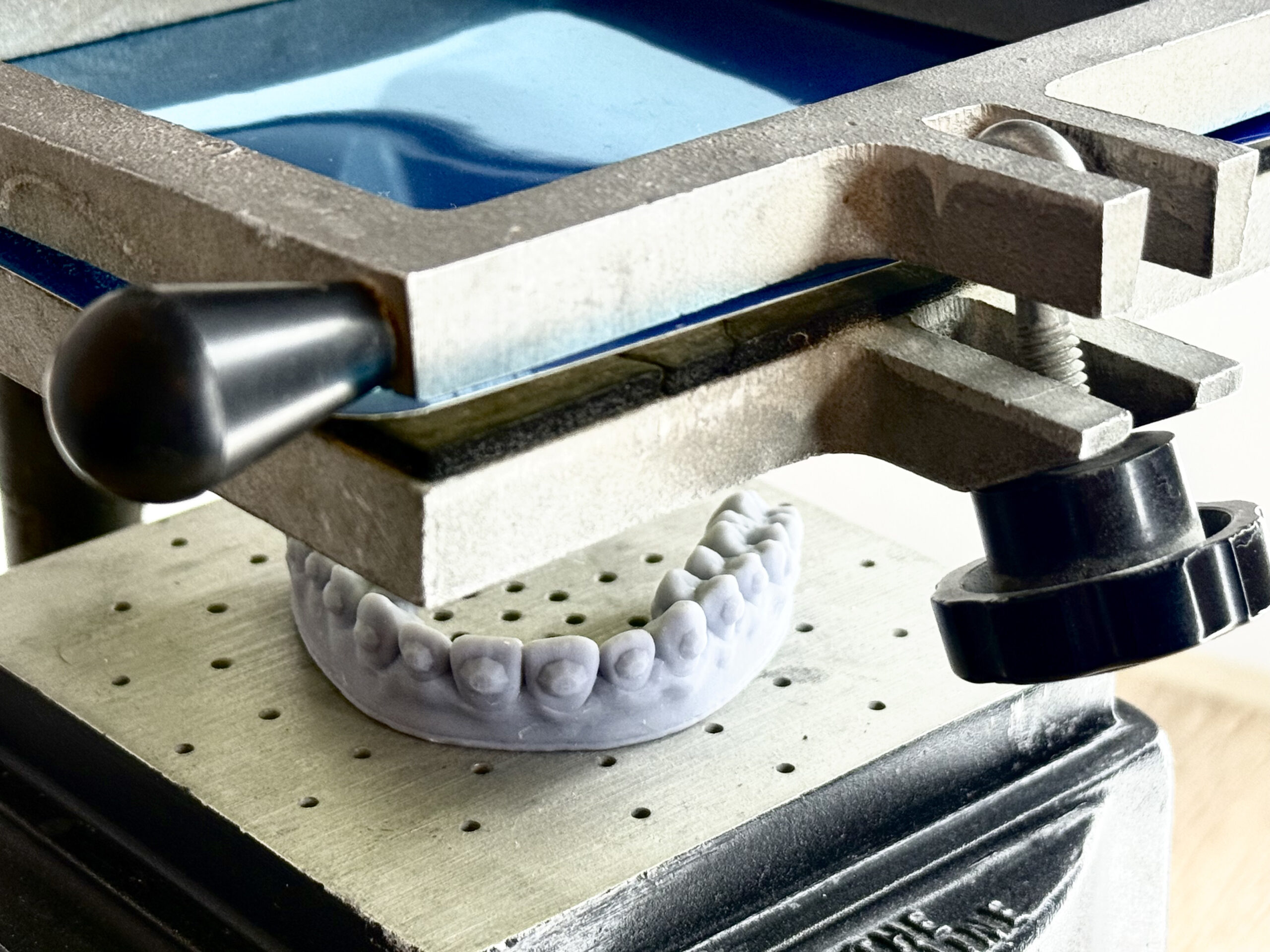 wybielanie-zebow-nakladkowe-pressdots